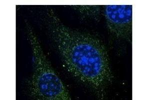 Anti-Rab14 Ab at 1/500 dilution, lysates at 50 µg per Iane, rabbit polyclonal to goat lµg (HR? (RAB5 antibody  (C-Term))