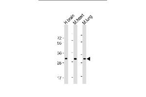All lanes : Anti-CH25H Antibody (N-Term) at 1:1000-1:2000 dilution Lane 1: Human brain lysate Lane 2: Mouse heart lysate Lane 3: Mouse lung lysate Lysates/proteins at 20 μg per lane. (CH25H antibody  (AA 47-76))