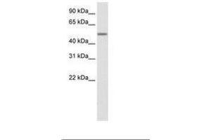 Image no. 1 for anti-Zinc Finger Protein 823 (ZNF823) (AA 422-471) antibody (ABIN6736099) (ZNF823 antibody  (AA 422-471))