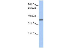 GALE antibody used at 1 ug/ml to detect target protein. (GALE antibody  (N-Term))