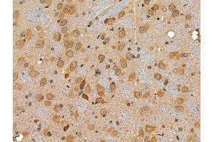 ABIN6257637 and ABIN6274779 at 1/100 staining Rat brain tissue by IHC-P. (RPL34 antibody  (C-Term))