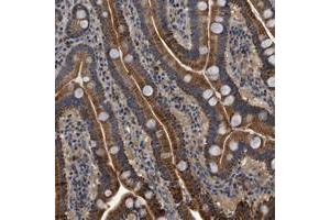 Immunohistochemical staining of human duodenum with KCNK1 polyclonal antibody  shows granular cytoplasmic positivity in glandular cells at 1:200-1:500 dilution. (KCNK1 antibody)