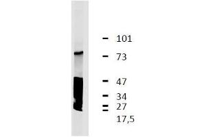 Western Blotting analysis (reducing conditions) of GARP antigen and its degradatory products in lysate of human thrombocytes by anti-GARP monoclonal antibody (GARP5). (LRRC32 antibody)