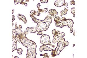 IHC analysis of MCUR1 using anti-MCUR1 antibody (ABIN6719261). (CCDC90A antibody)