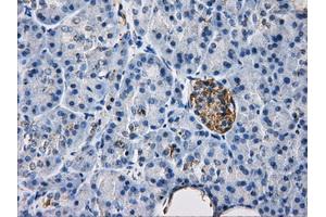 Immunohistochemical staining of paraffin-embedded liver tissue using anti-HDAC10mouse monoclonal antibody.