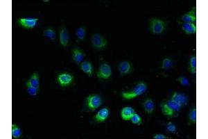 Immunofluorescent analysis of MCF-7 cells using ABIN7173019 at dilution of 1:100 and Alexa Fluor 488-congugated AffiniPure Goat Anti-Rabbit IgG(H+L) (TRAPPC10 antibody  (AA 1-55))