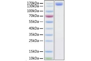 Recombinant Human ACE2 Protein was determined by SDS-PAGE with Coomassie Blue, showing a band at 140-150 kDa (ACE2 Protein (AA 18-740) (Fc Tag))