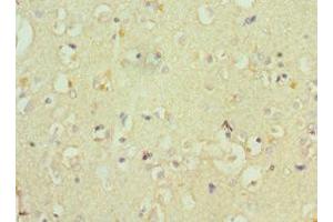 Immunohistochemistry (IHC) image for anti-ATPase, Cu++ Transporting, beta Polypeptide (ATP7B) (AA 1166-1465) antibody (ABIN7148555)