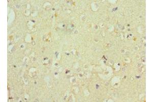 Immunohistochemistry of paraffin-embedded human brain tissue using ABIN7148555 at dilution of 1:100 (ATP7B antibody  (AA 1166-1465))