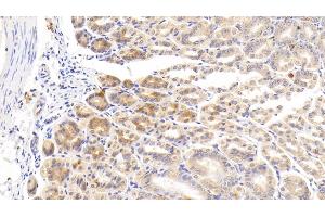 Detection of CDKN2B in Mouse Stomach Tissue using Polyclonal Antibody to Cyclin Dependent Kinase Inhibitor 2B (CDKN2B) (CDKN2B antibody  (AA 1-130))