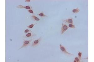 Immunocytochemistry analysis of Hela cells using ABIN7139167 at dilution of 1:100 (HIST1H4A antibody  (acLys16))