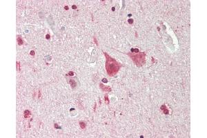 Human Brain, Cortex: Formalin-Fixed, Paraffin-Embedded (FFPE). (MXI1 antibody  (N-Term))