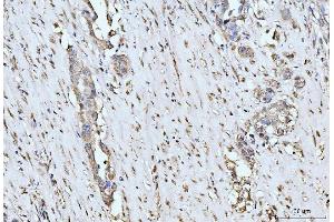 IHC analysis of MOV10 using anti-MOV10 antibody (ABIN7600236). (MOV10 antibody  (AA 167-772))
