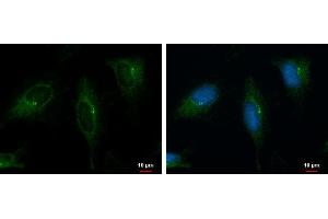 ICC/IF Image PKD2 antibody [C1C3] detects PKD2 protein at cytoplasm by immunofluorescent analysis. (PKD2 antibody)