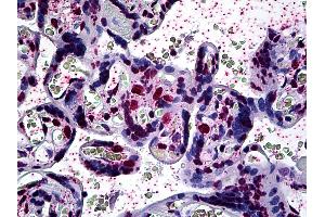 Anti-ARID3A antibody IHC of human placenta. (ARID3A antibody  (AA 317-417))