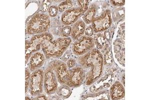 Immunohistochemical staining of human kidney with LTV1 polyclonal antibody  shows moderate cytoplasmic and membranous positivity in cells in tubules at 1:500-1:1000 dilution. (LTV1 antibody)
