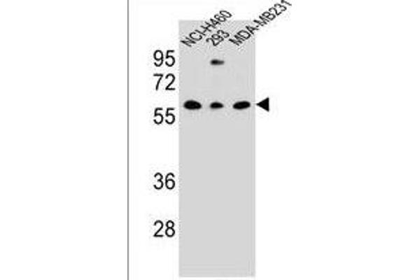 CLEC17A antibody  (C-Term)