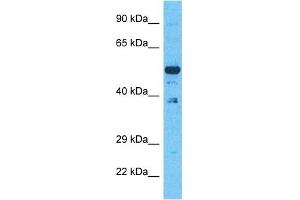 Host:  Rabbit  Target Name:  EVI2B  Sample Type:  293T Whole Cell lysates  Antibody Dilution:  1. (EVI2B antibody  (C-Term))