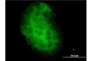 Immunofluorescence of monoclonal antibody to KLK10 on A-431 cell. (Kallikrein 10 antibody  (AA 167-276))