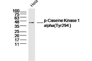 Hela lysates probed with Casein Kinase 1 alpha (Tyr294) Antibody, Unconjugated  at 1:300 dilution and 4˚C overnight incubation. (CSNK1A1 antibody  (pTyr294))