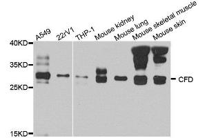 Western blot analysis of extract of various cells, using CFD antibody. (Adipsin antibody)
