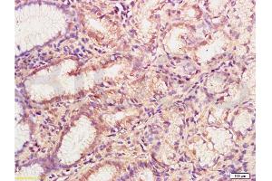 Formalin-fixed and paraffin embedded human gastric mucosa labeled with Anti-MMP-3 Polyclonal Antibody , Unconjugated at 1:200, followed by conjugation to the secondary antibody and DAB staining (MMP3 antibody  (AA 401-477))