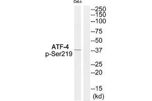 Western blot analysis of extracts from COLO cells using ATF-4 (Phospho-Ser219) Antibody. (ATF4 antibody  (pSer219))
