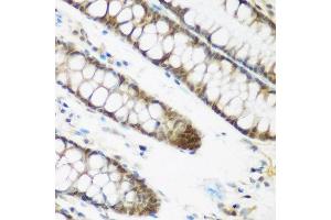 Immunohistochemistry of paraffin-embedded human colon using NCBP2 antibody at dilution of 1:200 (40x lens).