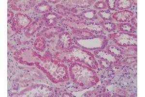 Human Kidney: Formalin-Fixed, Paraffin-Embedded (FFPE) (GSTM1 antibody)