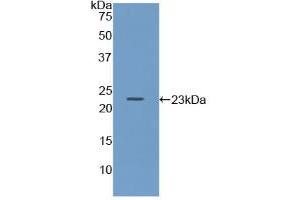 Western blot analysis of recombinant Mouse Iga. (CD79a antibody  (AA 30-193))