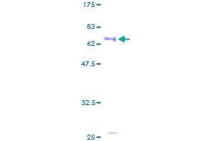PPM1A Protein (AA 1-382) (GST tag)