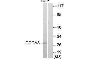 Immunohistochemistry analysis of paraffin-embedded human colon carcinoma tissue using CDCA3 antibody.