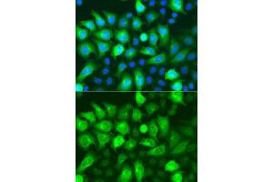 Immunofluorescence analysis of A549 cells using RRM2 antibody (ABIN5973030). (RRM2 antibody)