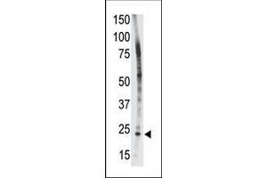 The anti-Bid BH3 domain Pab (ABIN388099 and ABIN2846183) is used in Western blot to detect Bid BH3 in HL-60 cell lysate. (BID antibody  (AA 68-103))