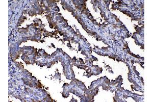 IHC analysis of Calpain 2 using anti-Calpain 2 antibody . (Calpain 2 antibody  (AA 500-700))