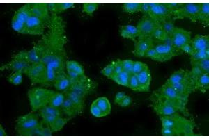 anti-Carbonic Anhydrase II (CA2) (AA 2-260) antibody