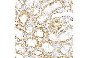 Immunofluorescence analysis of PC-12 cells using RMDN3 Rabbit pAb (ABIN6127274, ABIN6146979, ABIN6146981 and ABIN6221512) at dilution of 1:250 (40x lens). (RMDN3 antibody  (AA 171-470))