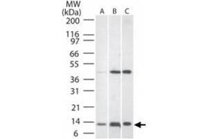 Western blot analysis of TNFRSF12A in A) human liver lysate, B) mouse liver tissue lysate, and C) rat liver lysate.