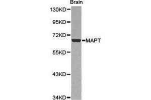 Western Blotting (WB) image for anti-Microtubule-Associated Protein tau (MAPT) antibody (ABIN1873639)