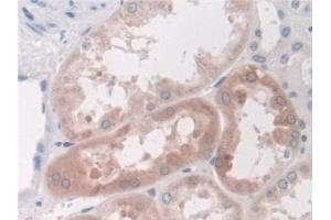 Detection of LDHD in Human Kidney Tissue using Polyclonal Antibody to Lactate Dehydrogenase D (LDHD) (LDHD antibody  (AA 62-265))