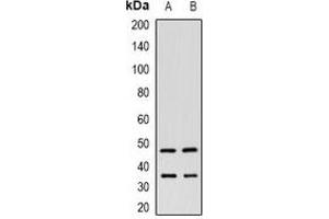 Western blot analysis of ITPK1 expression in HeLa (A), HepG2 (B) whole cell lysates.