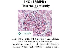 Image no. 1 for anti-FERM and PDZ Domain Containing 4 (FRMPD4) (Internal Region) antibody (ABIN1734472) (FRMPD4 antibody  (Internal Region))