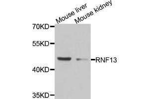 Western blot analysis of extracts of mouse liver and mouse kidney cell lines, using RNF13 antibody. (RNF13 antibody)