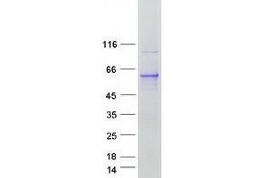 Western Blotting (WB) image for Ras-Related GTP Binding D (RRAGD) protein (Myc-DYKDDDDK Tag) (ABIN2731193)