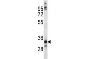 NKX6. (NKX6-1 antibody  (AA 284-312))