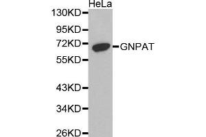 Western Blotting (WB) image for anti-Glyceronephosphate O-Acyltransferase (GNPAT) antibody (ABIN1872854) (GNPAT antibody)