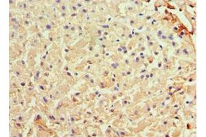 Immunohistochemistry of paraffin-embedded human liver tissue using ABIN7144581 at dilution of 1:100 (Liver Arginase antibody  (AA 1-322))