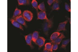 Immunofluorescence staining (rat basophils) Immunofluorescence staining of vesicles (red) in RBL-2H3 rat basophilic leukemia cell line using anti-Kinesin (KN-02). (Kinesin (heavy chain) antibody)