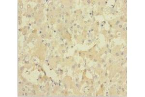 Immunohistochemistry of paraffin-embedded human liver tissue using ABIN7151627 at dilution of 1:100 (NEIL1 antibody  (AA 2-390))
