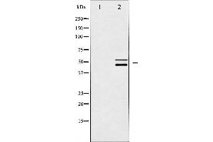 Western blot analysis of Shc expression in CalyculinA treated HeLa whole cell lysates,The lane on the left is treated with the antigen-specific peptide. (SHC1 antibody)